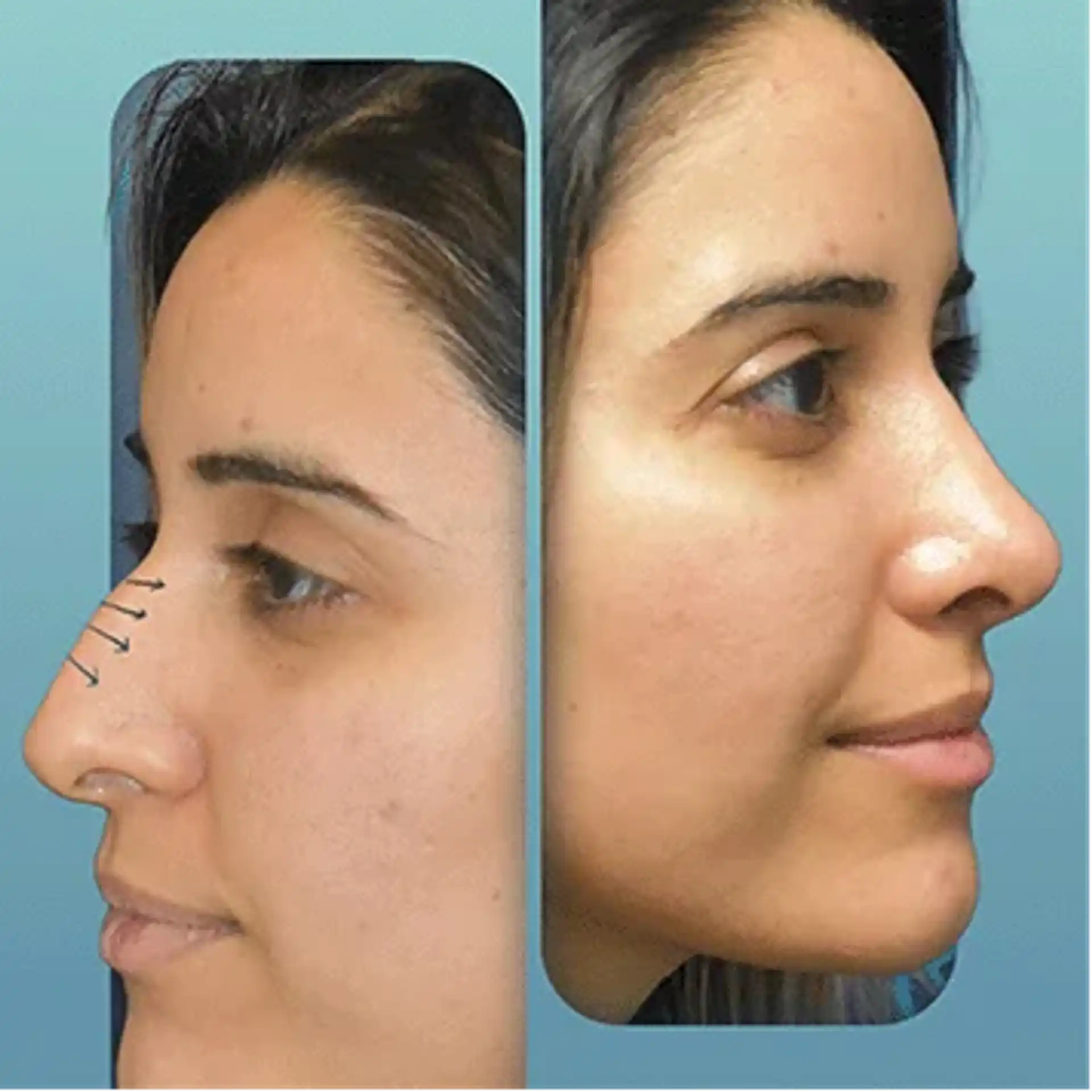 Plastic surgery