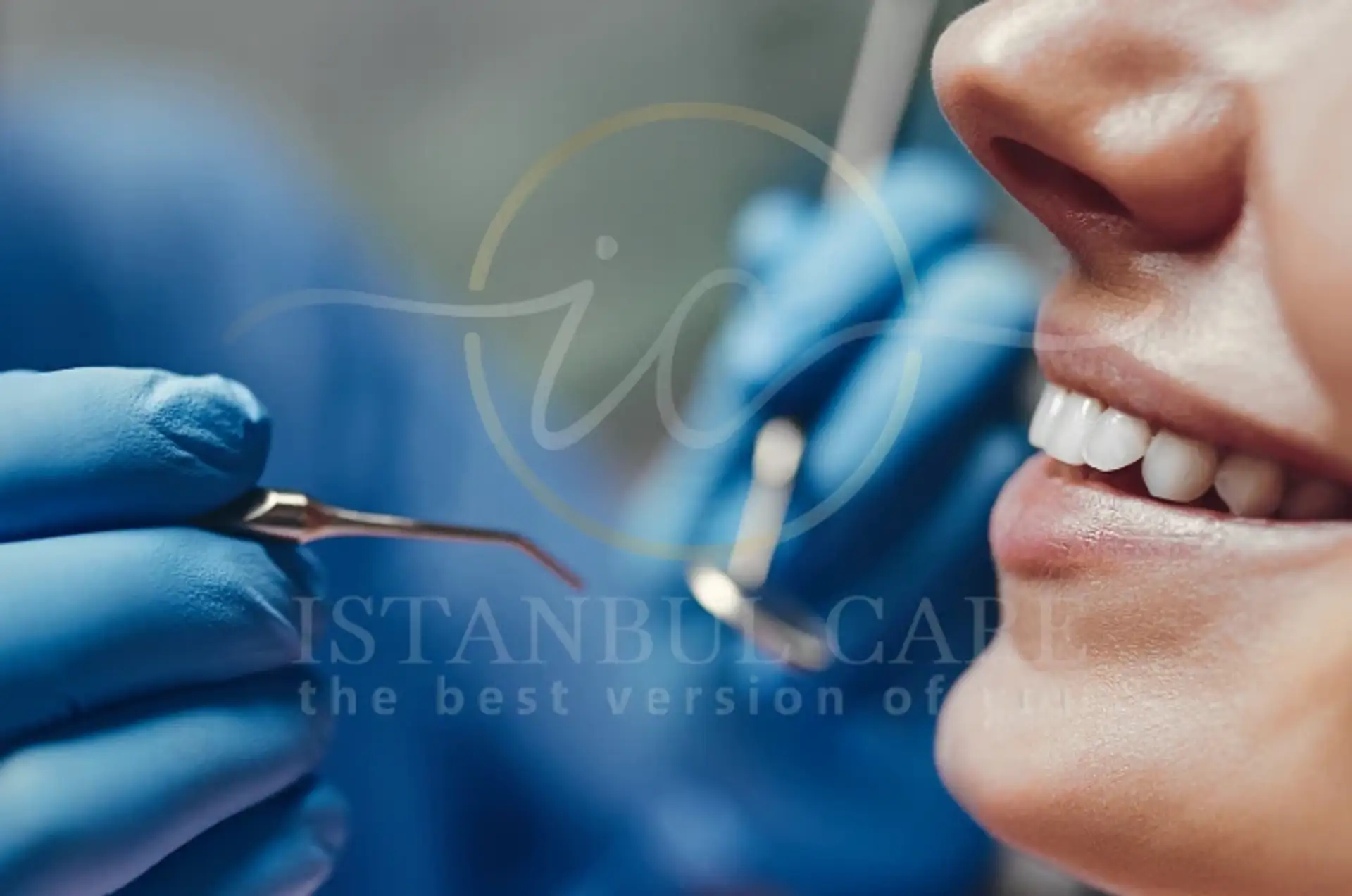 All-on-4 Dental Implant