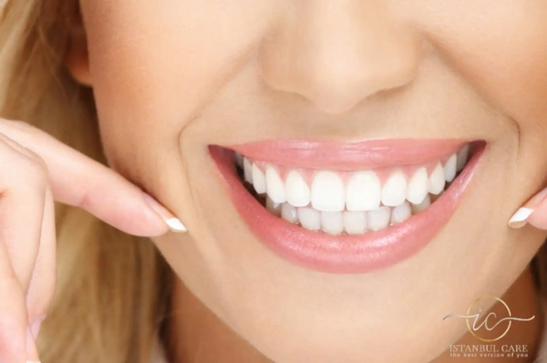 Comprehensive Aftercare Guide for Your Hollywood Smile