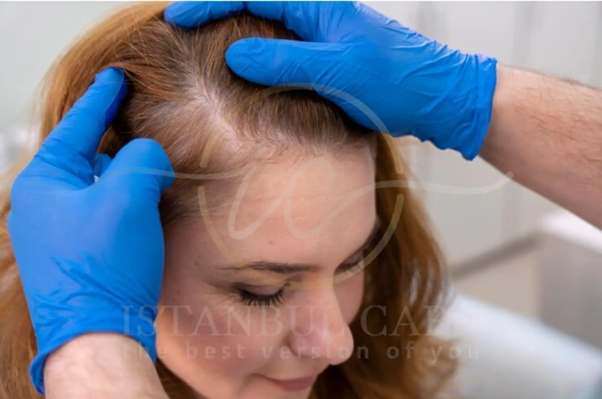 Understanding Hair Papilla Cells and Regrowth