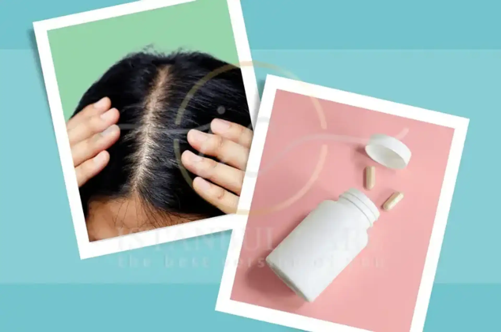 Biotin for Hair Growth: Benefits and Dosage Guide