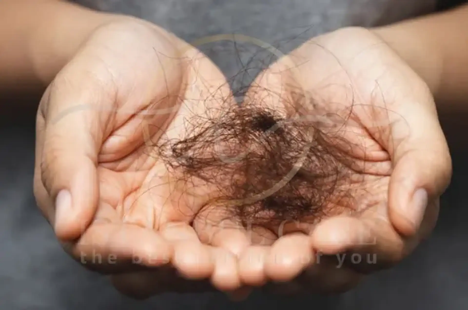 Understanding Female Hair Loss: Causes & Solutions