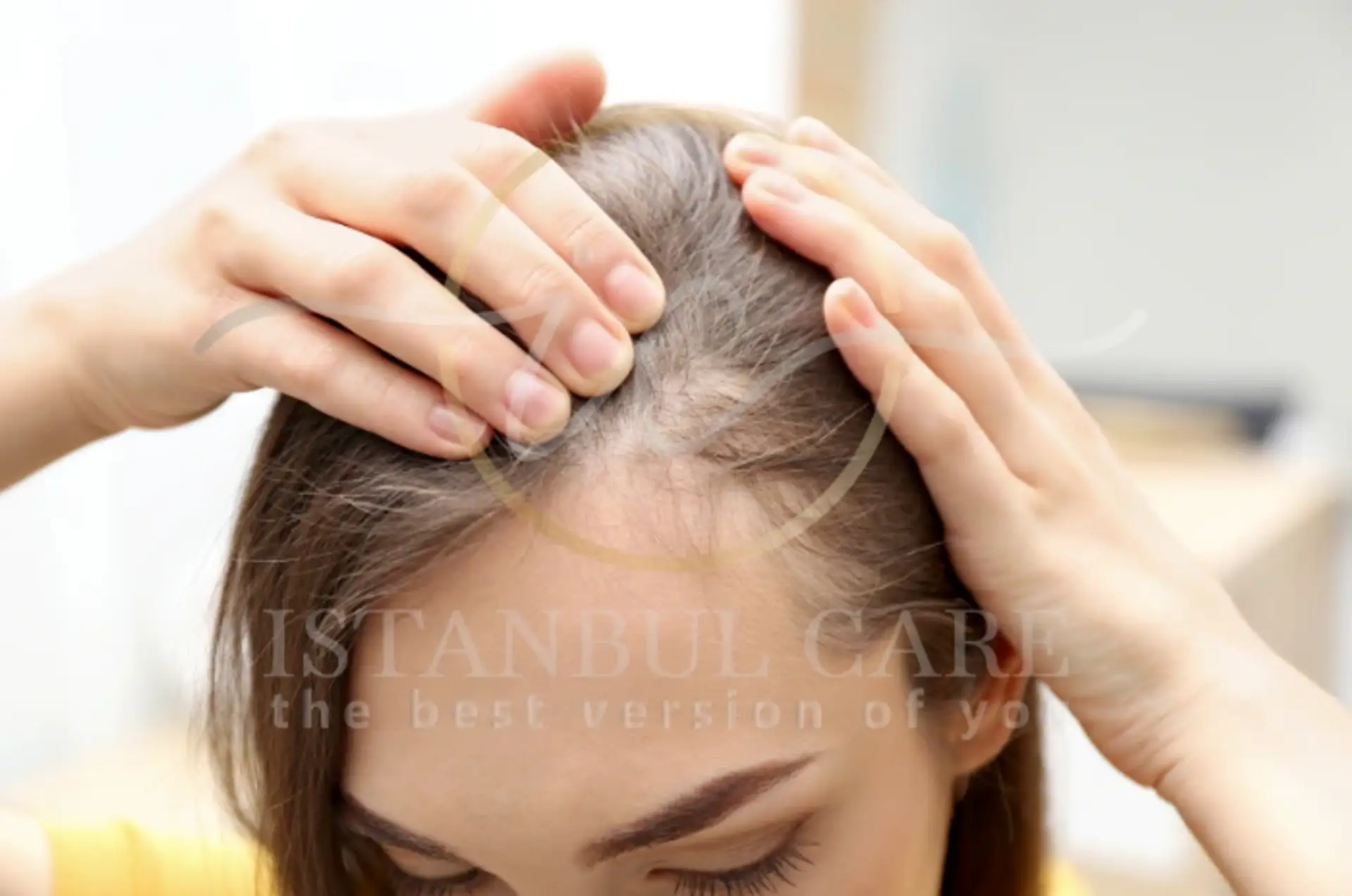Dutasteride for Hair Loss: Benefits & Side Effects