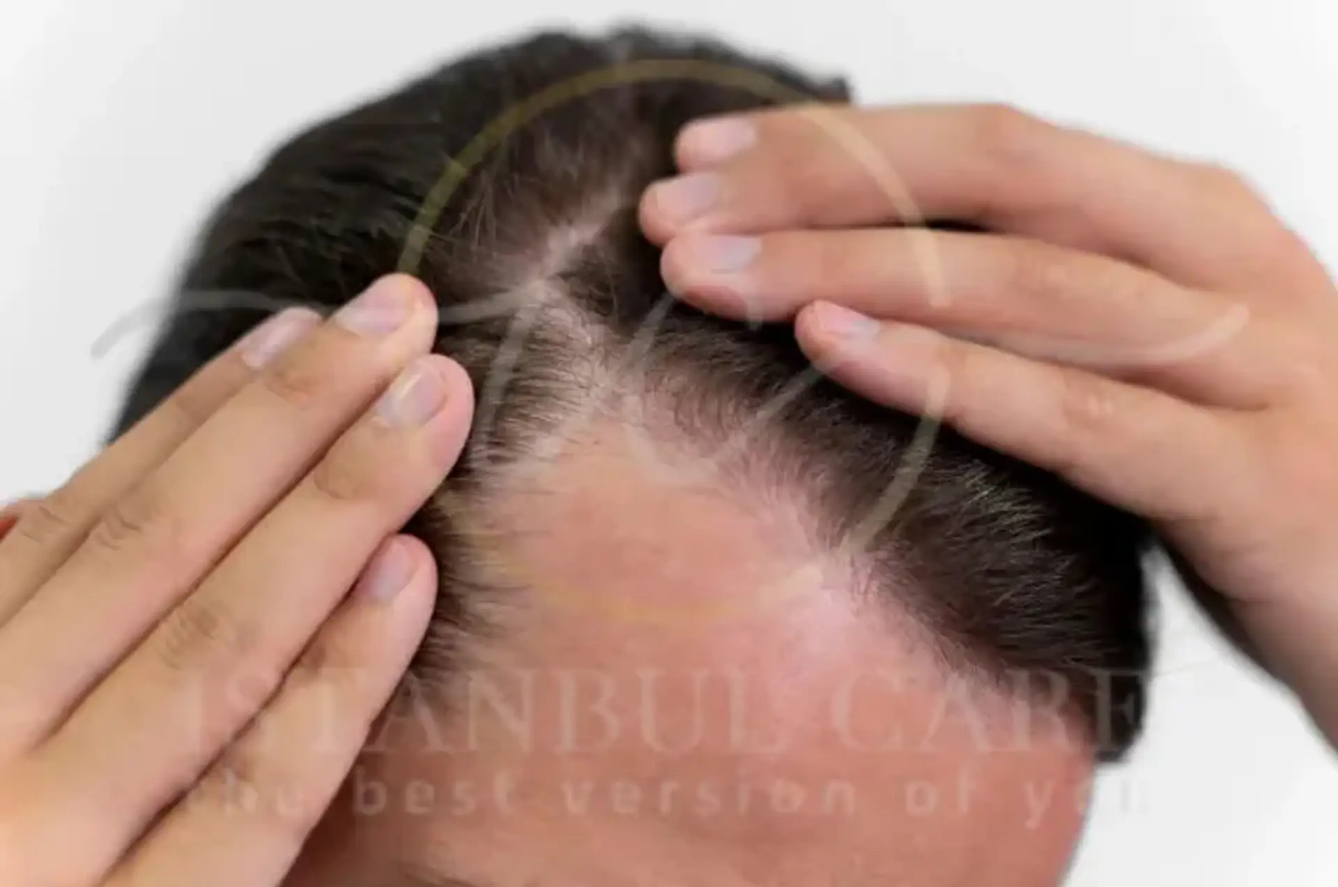 Key Tips for Achieving and Maintaining Healthy Hair