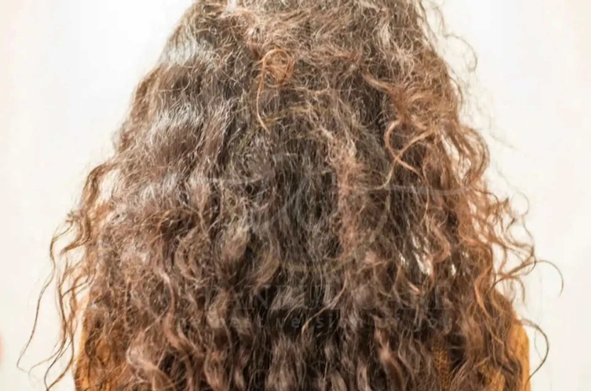 Understanding the Causes and Care of Gray Hair