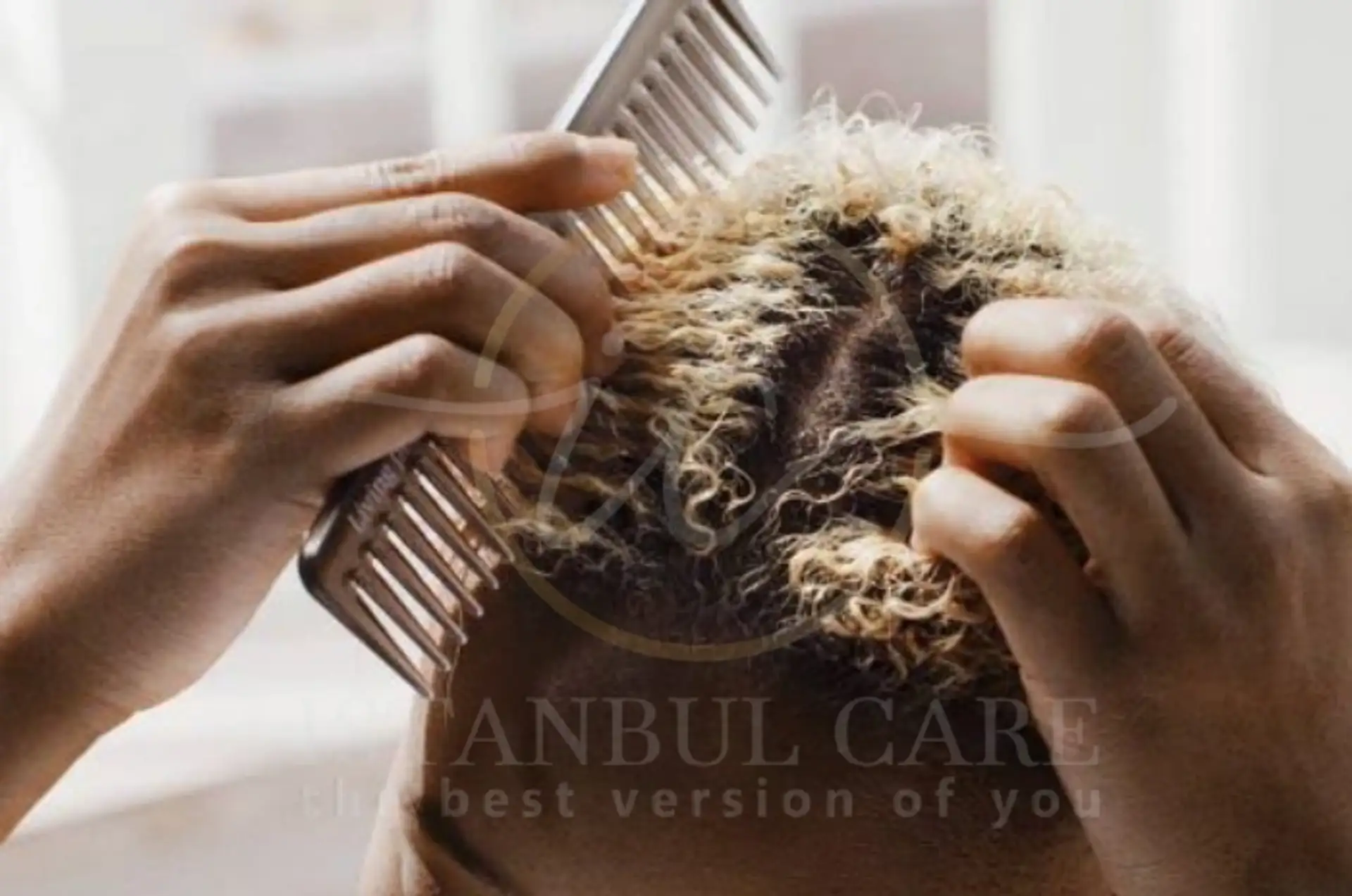 Understanding Dry Scalp: Causes and Treatments