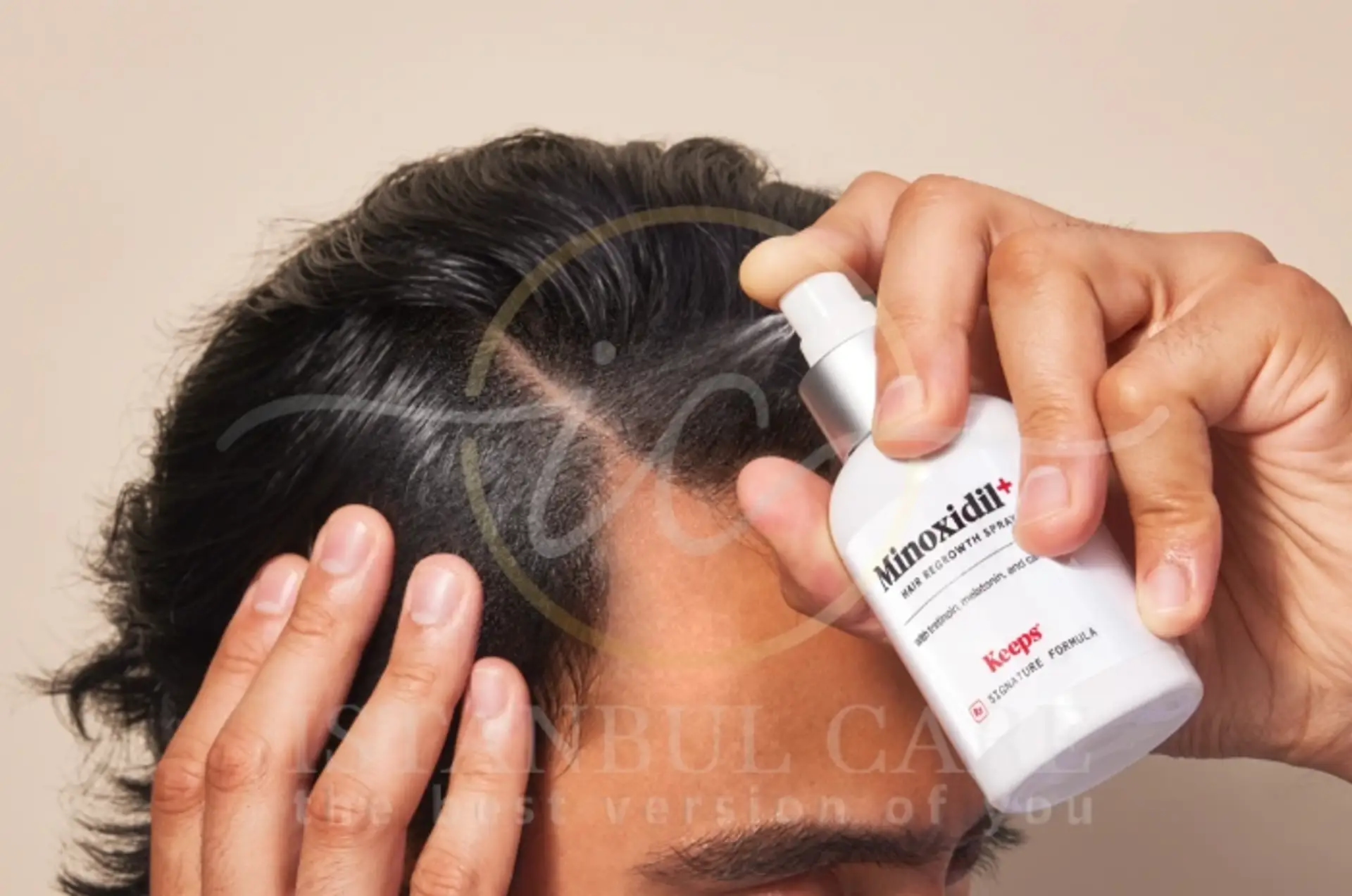 Understanding Minoxidil for Hair Loss Treatment