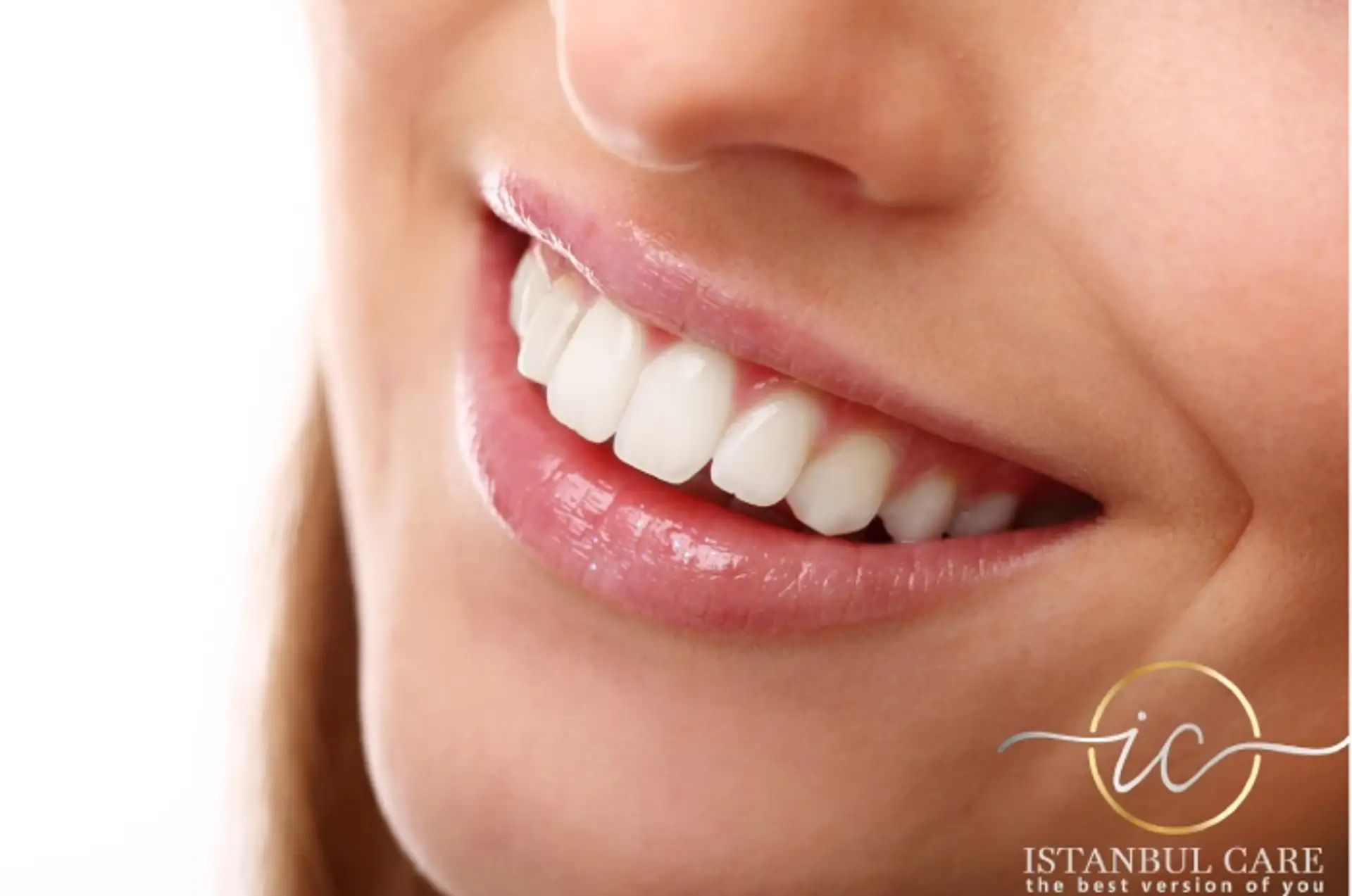 Smile Makeover in Turkey - Exceptional Dental Care