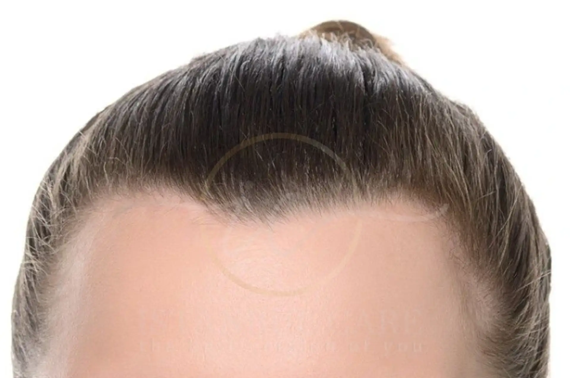 Widow’s Peak Meaning Causes and How to Style or Fix It