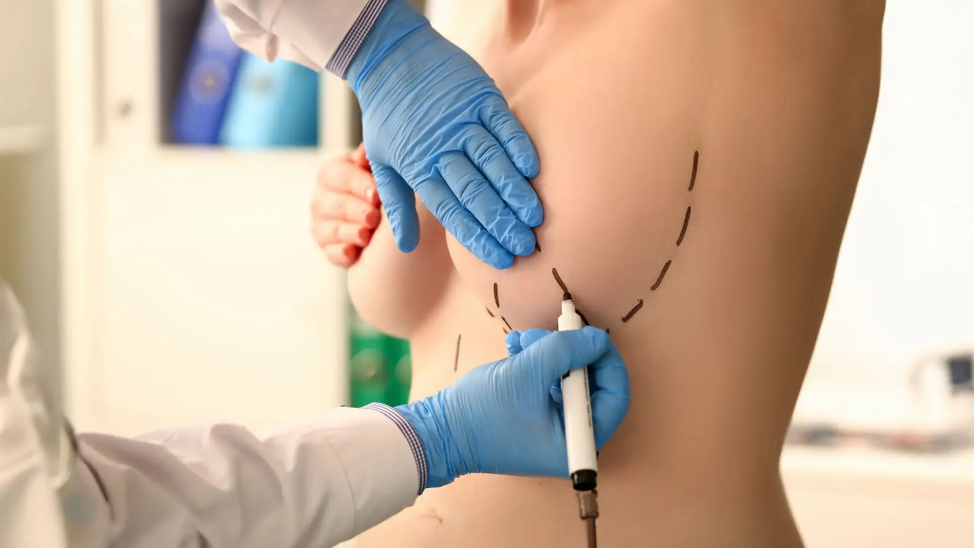 Reductia sanilor la Istanbul Care