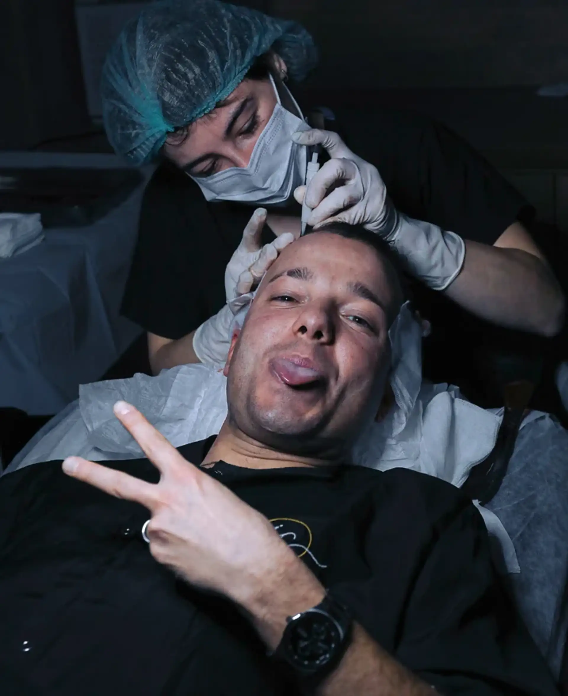 DHI Hair Transplant in Turkey