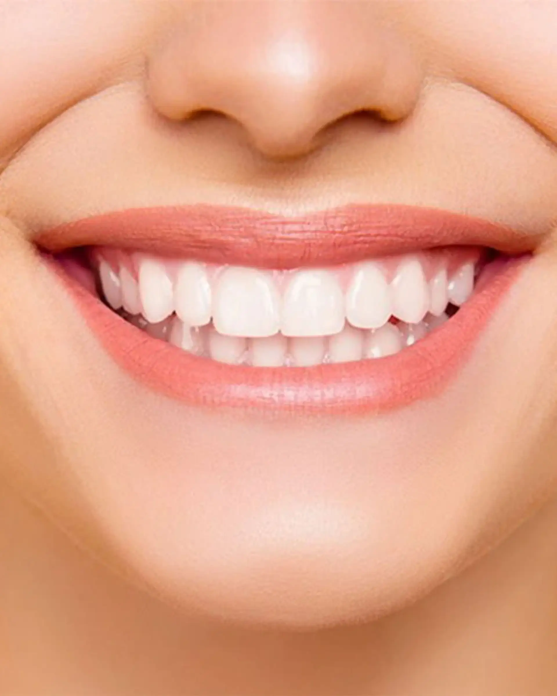 Hollywood Smile Aftercare
