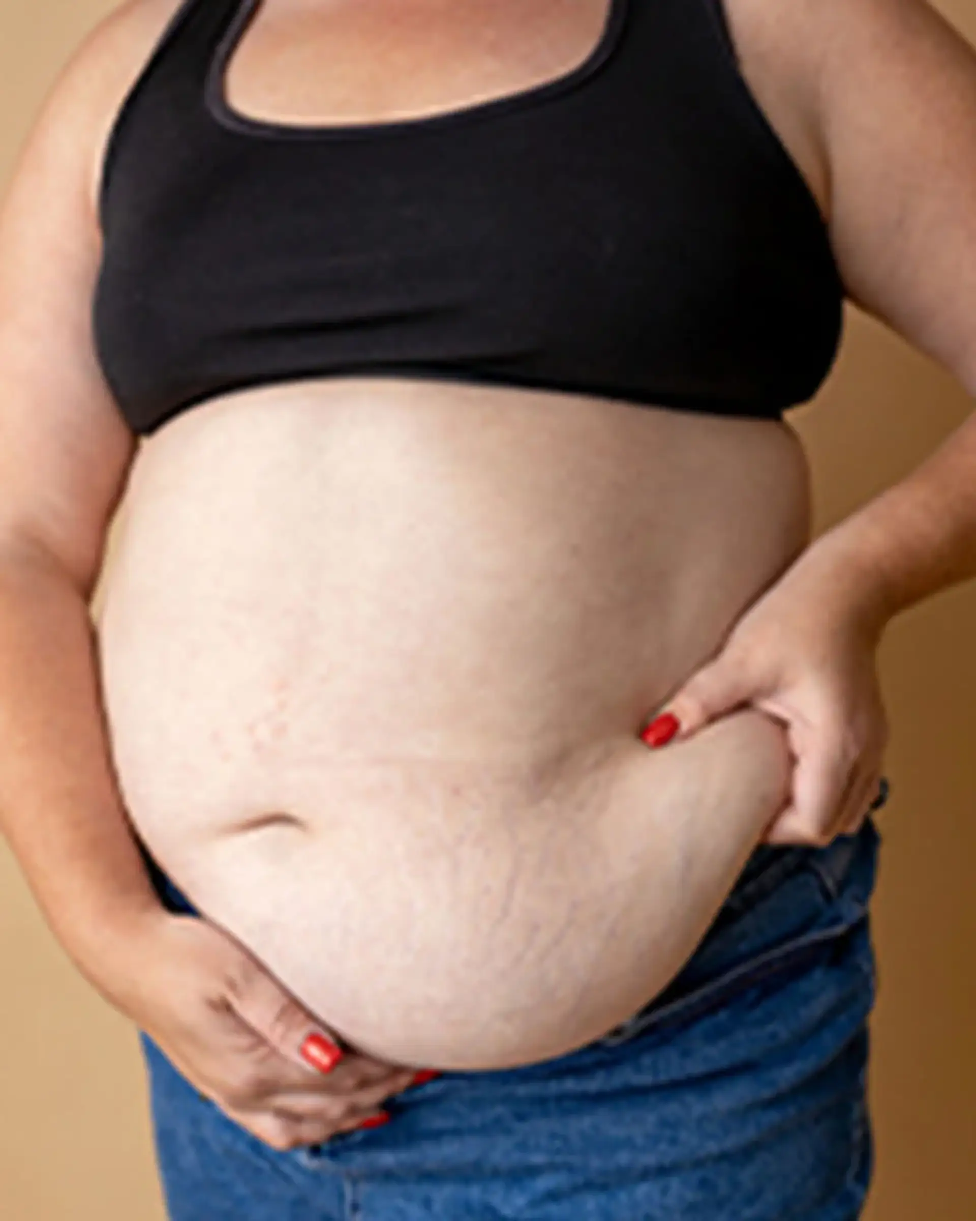 Cum îi ajută bandajul gastric pe pacienți să piardă în greutate?