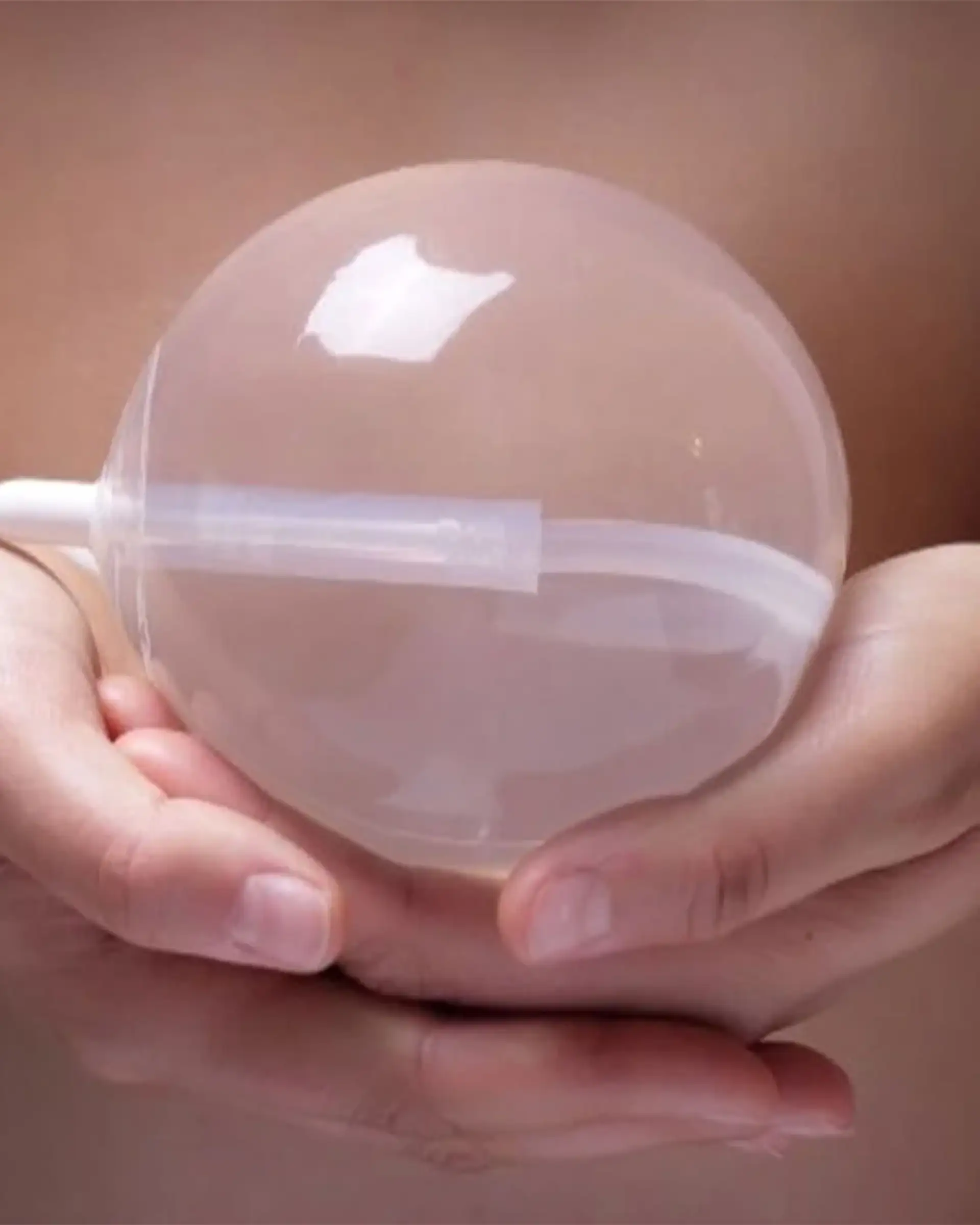 Comment le ballon gastrique est-il inséré ?