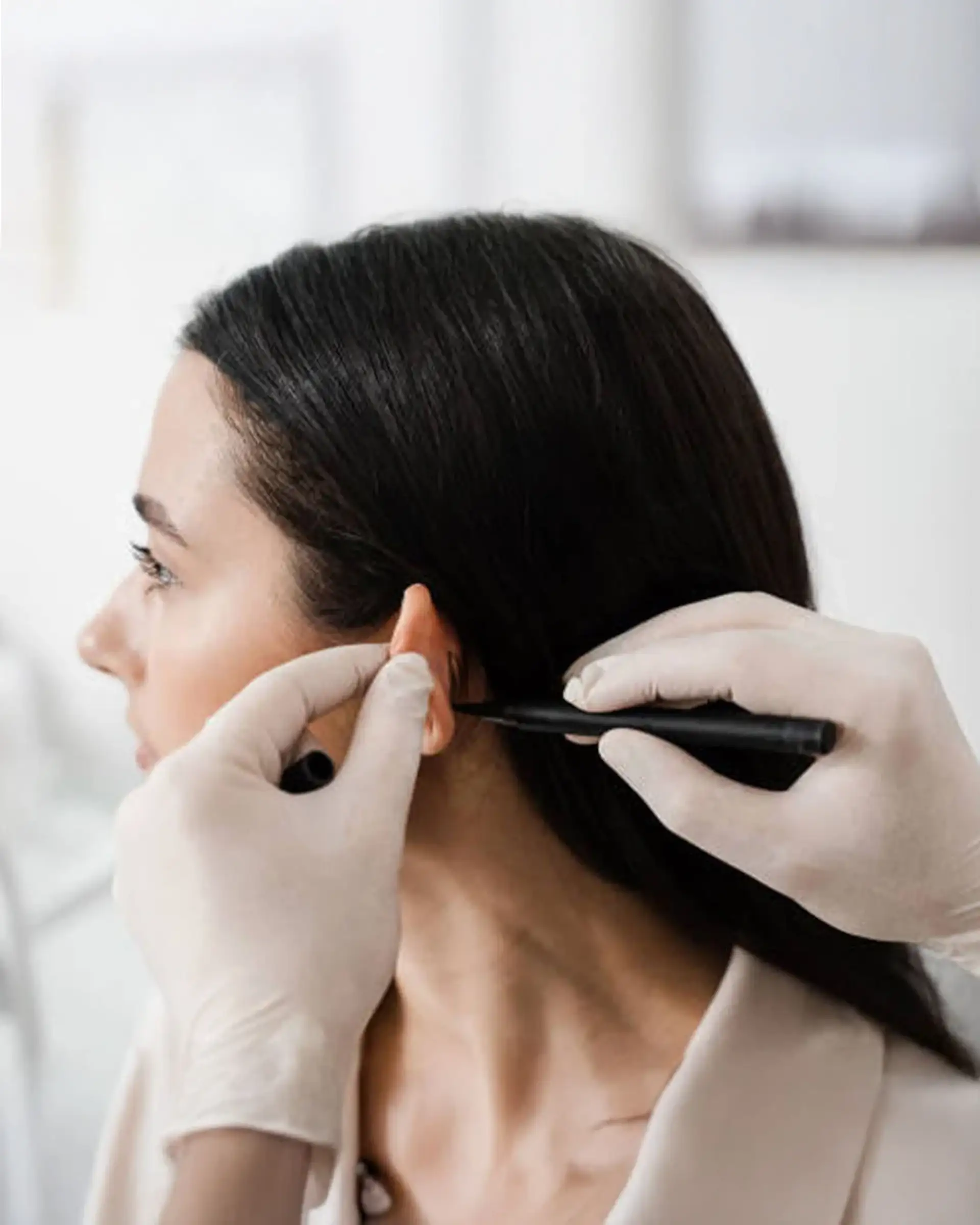 How to Prepare for Otoplasty Surgery