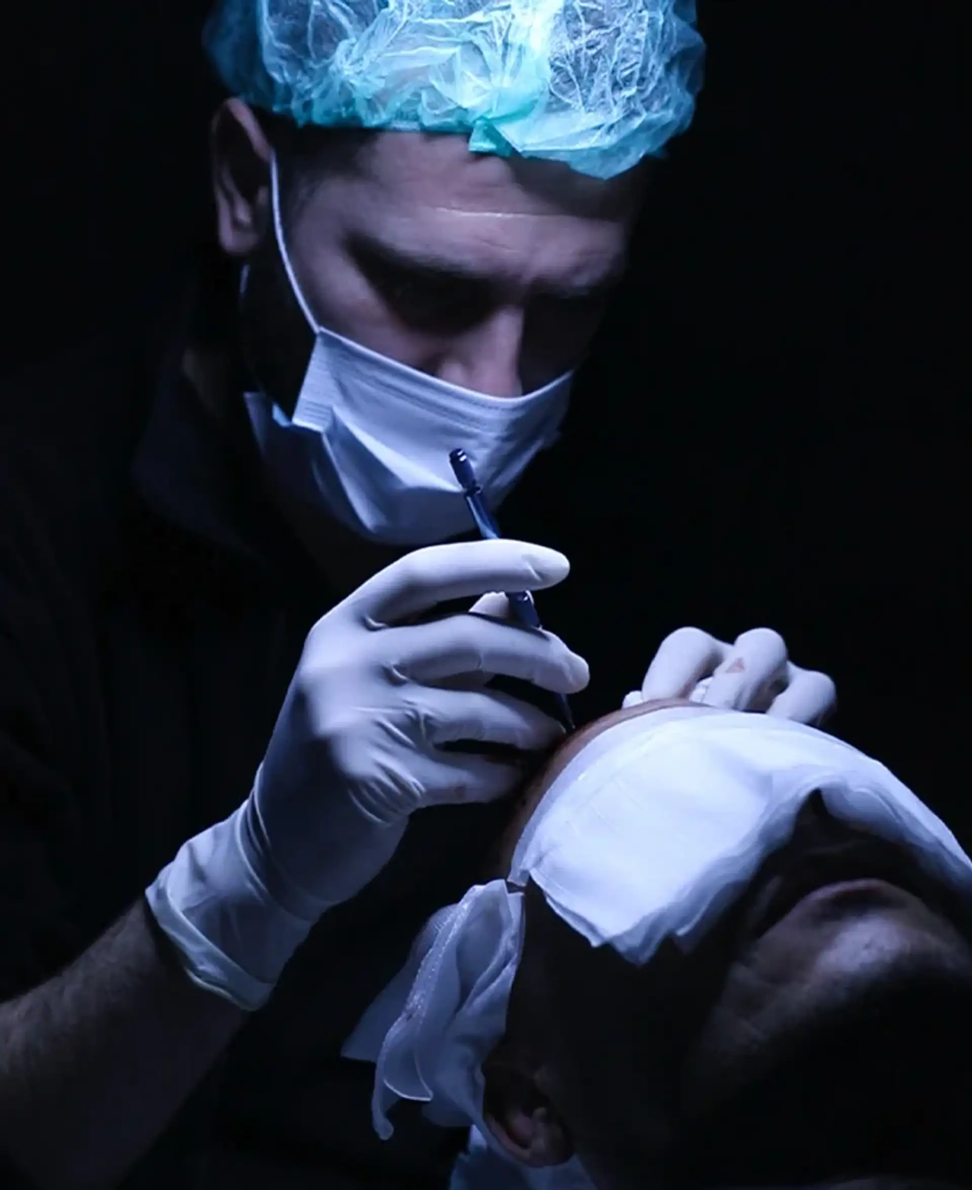 Sapphire FUE Hair Transplant in Turkey