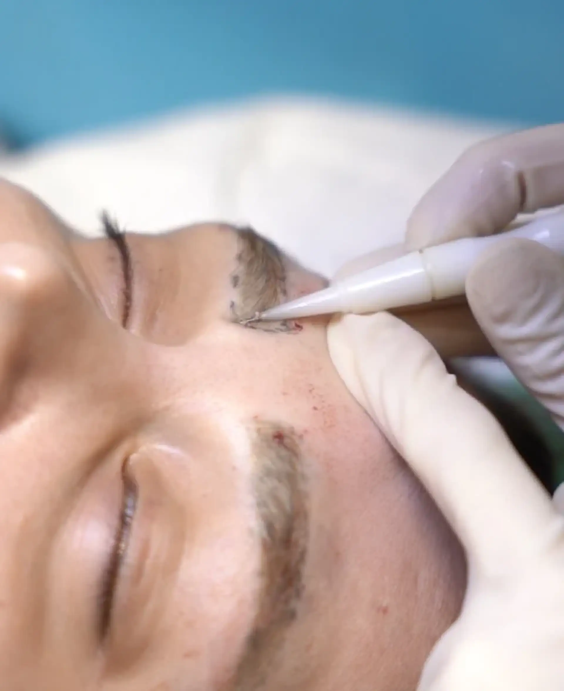 Solutions for Over-plucked or Thin Eyebrows