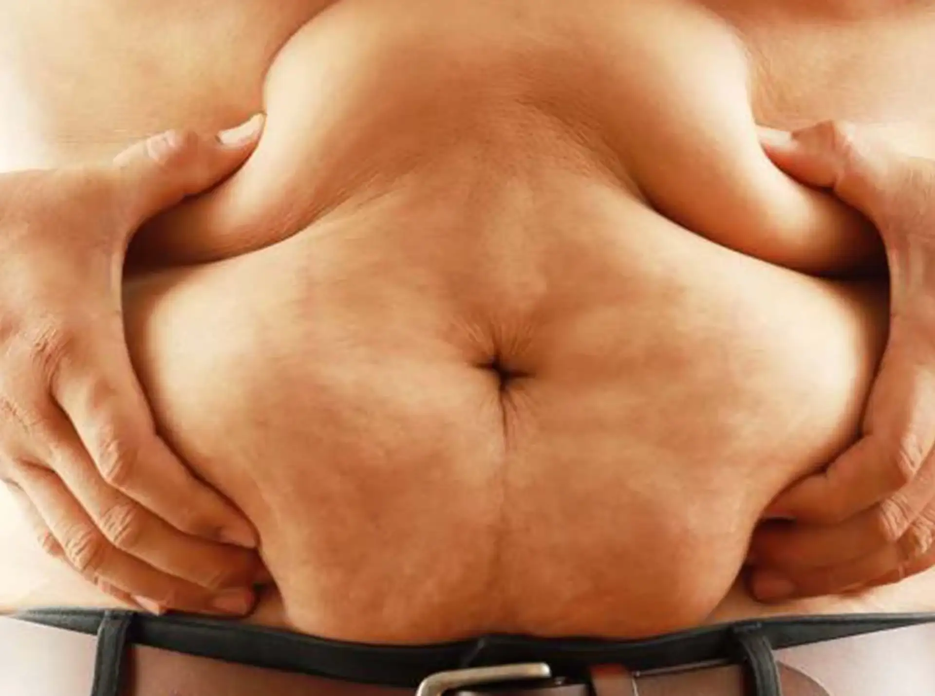 Zone mirate per la mega liposuzione sull'addome