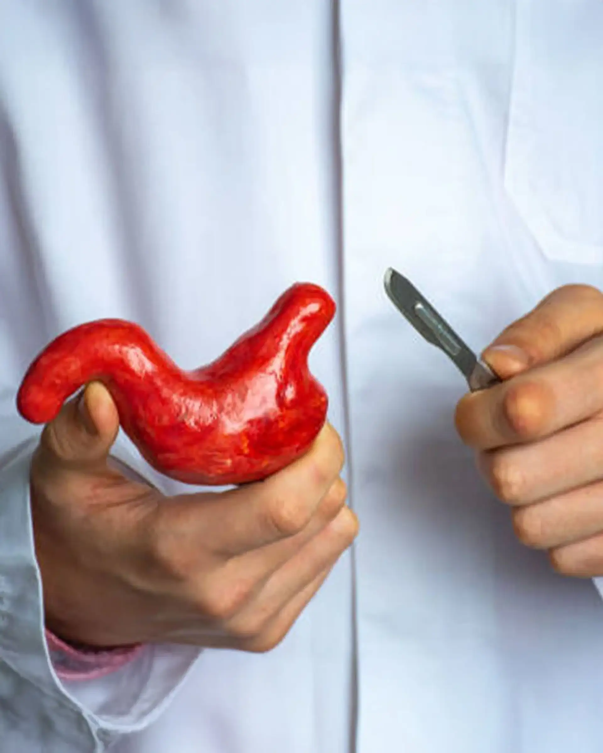 Médico sosteniendo un modelo de estómago y un bisturí.
