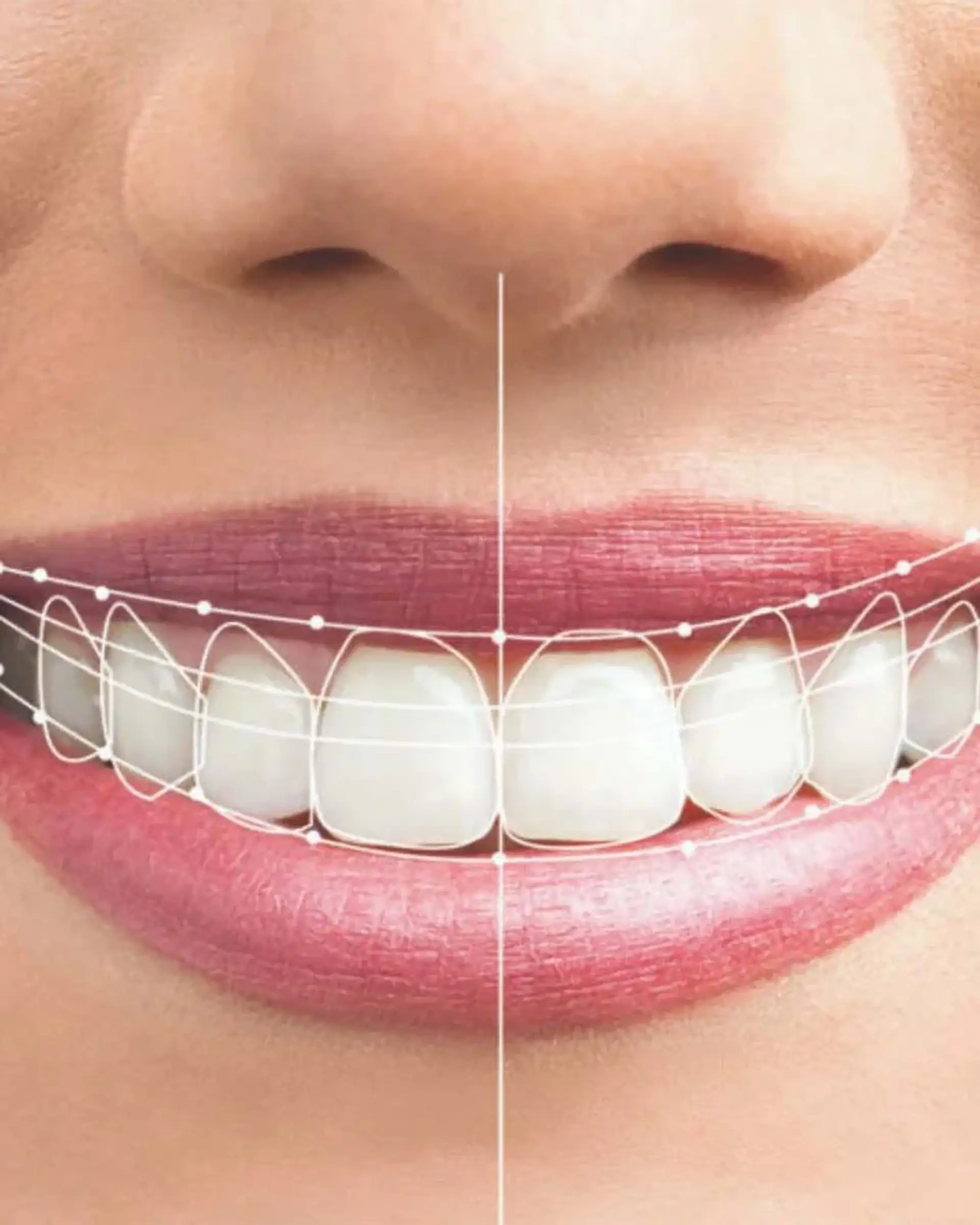 dental