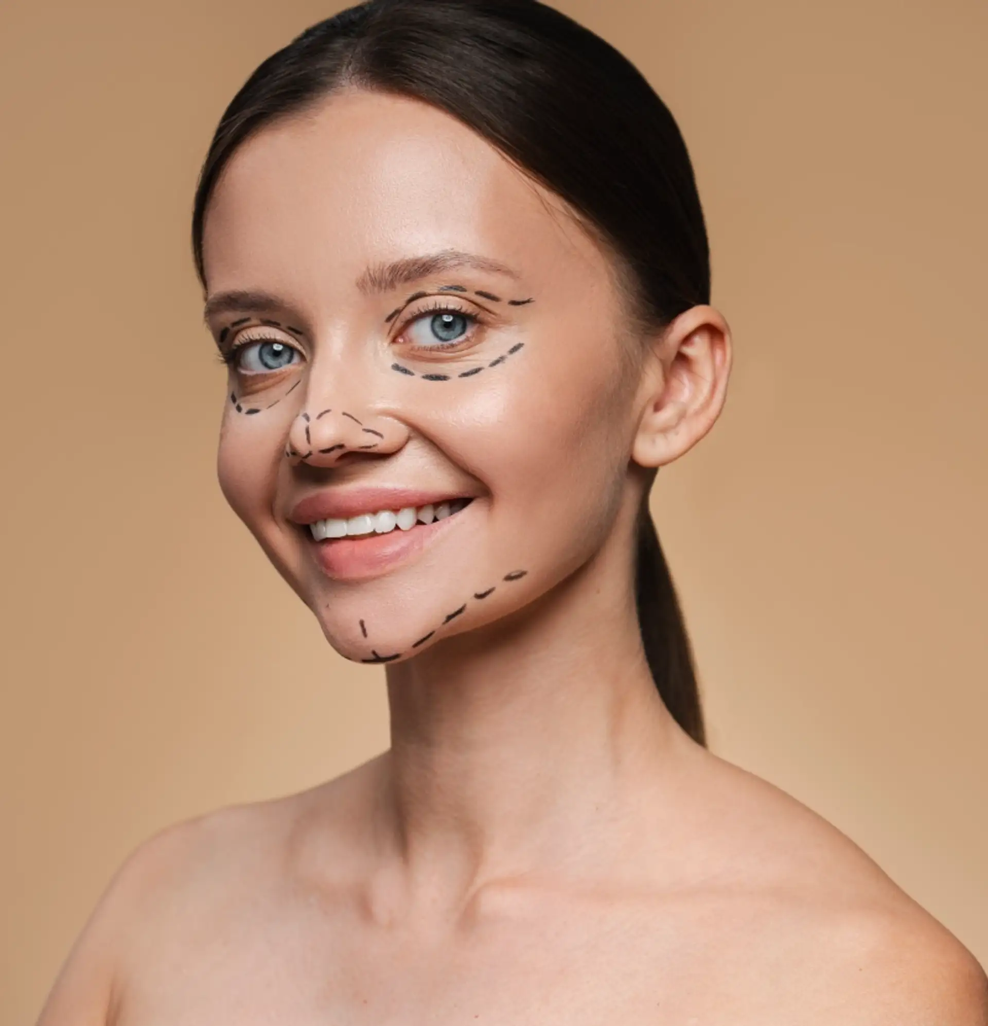 După operația de lifting facial în Turcia