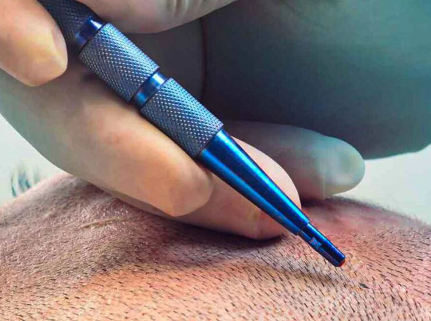 Learn Sapphire Pen Technique for Better Results